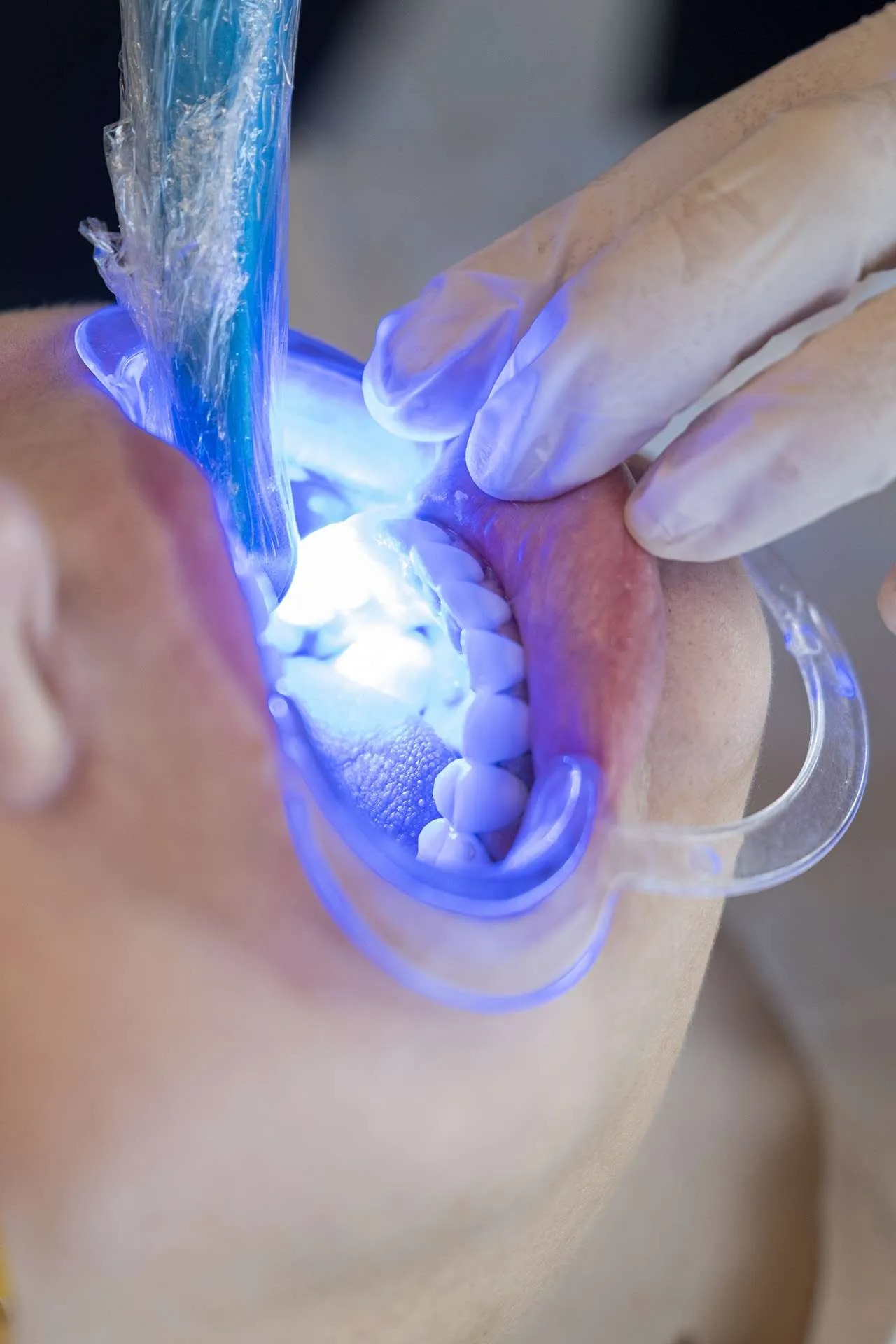 Odontoiatria conservativa estetica a Pisa